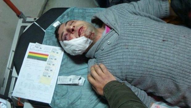 Okmeydanı Hastanesi önünde polise taşlı saldırı İZLE