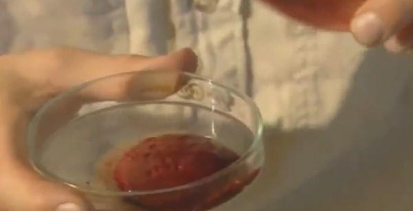 Yılanın zehri insan kanını pıhtılaştırıyor İZLE