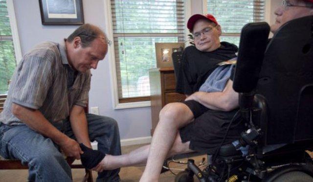 ABD'li ikizler 62 yıldır birbirlerine yapışık yaşıyorlar