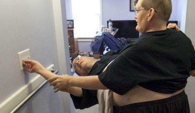 ABD'li ikizler 62 yıldır birbirlerine yapışık yaşıyorlar