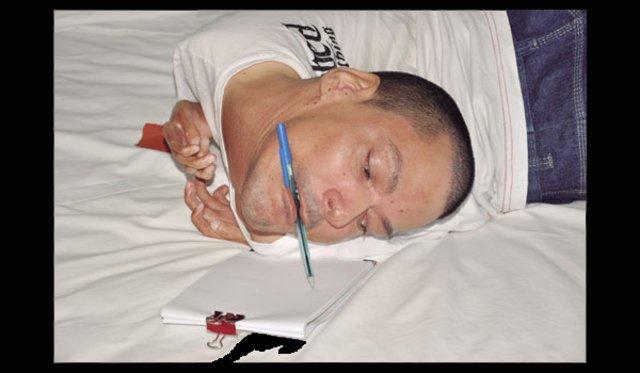 Brezilya'da boynu ters doğan adam 37 yaşında