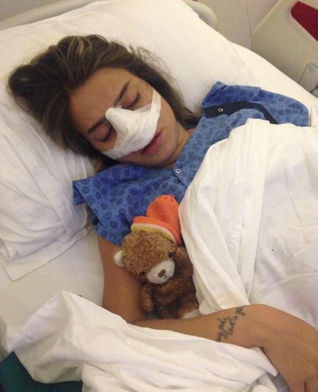 Ceyda Ateş'in burnu kırıldı