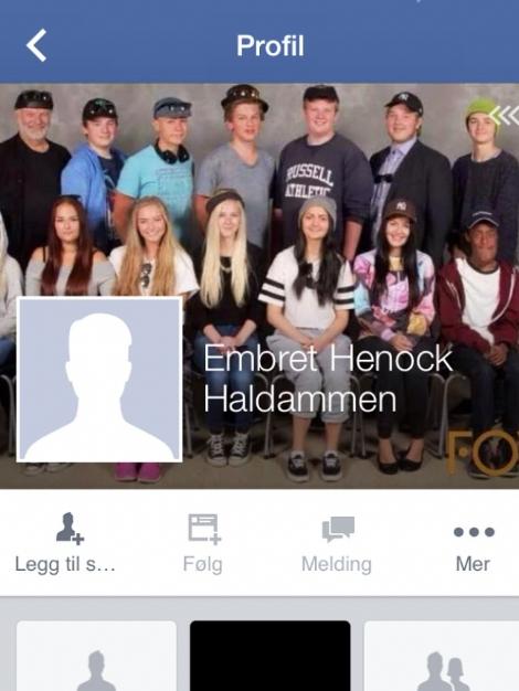 Facebook yüzünde rahatsızlık olan gencin profilini sildi