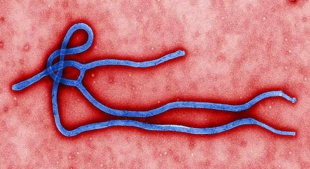Madde madde ölümcül Ebola virüsü