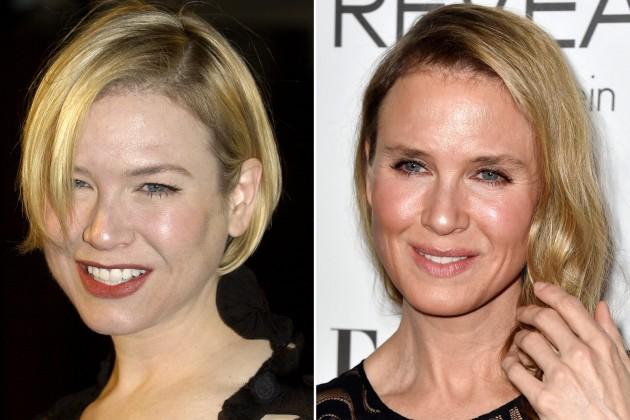 Renee Zellweger Michael Jackson sendromuna yakalandı