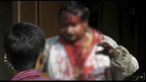 Leopar bir kişinin kafa derisini uçurdu