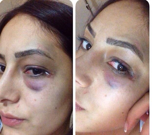 Nil Burak'ın oğlu davalık oldu