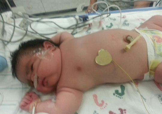 ABD'de 6 kiloluk bir bebek doğdu