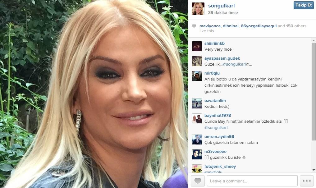 Songül Karlı estetik yaptırdı