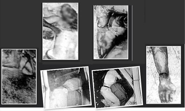 ASELSAN mühendisinin ölümüyle ilgili şok fotoğraflar