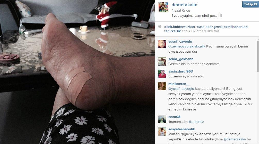 Demet Akalın'ın ayağına cam battı