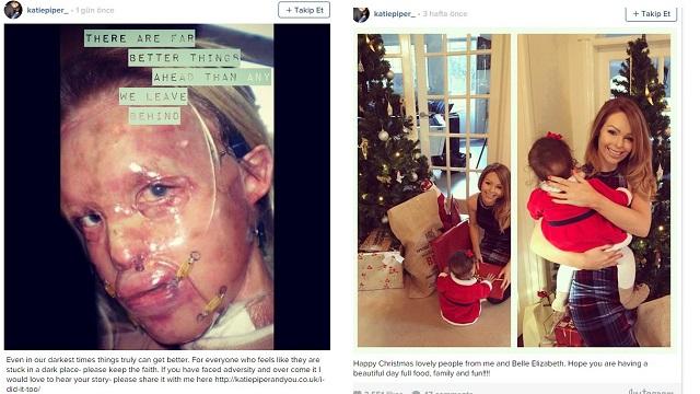 Katie Piper'in yeni yüzü