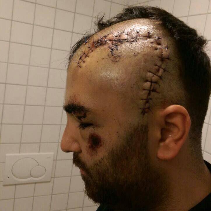 Almanya'da ikinci Tuğçe vakası