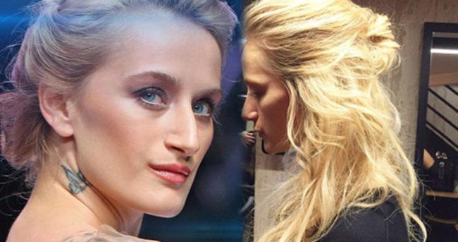 Didem Soydan burnuna estetik yaptırdı