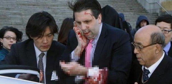 Güney Kore'de usturalı saldırı