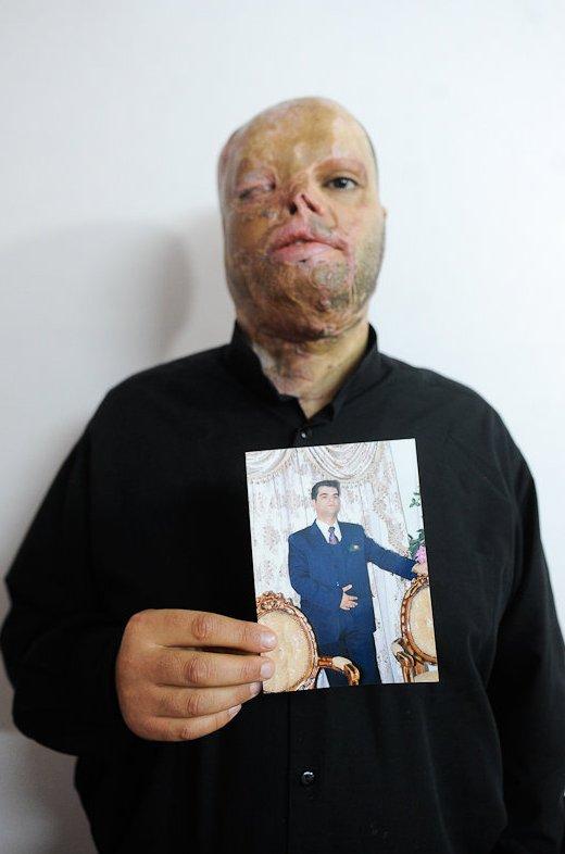 İran'da ilk kez kısasa kısas cezası uygulandı