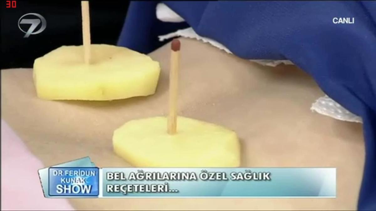 Feridun Kunak'ın programında tepki çeken tedavi yöntemi