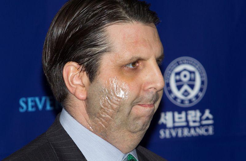 Amerikalı elçi Mark Lippert taburcu edildi