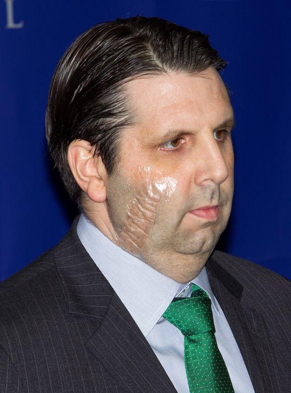 Amerikalı elçi Mark Lippert taburcu edildi