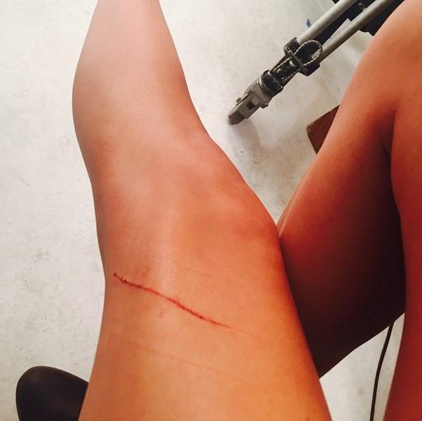 Kedisi Taylor Swift'in 40 milyon dolarlık bacağını çizdi