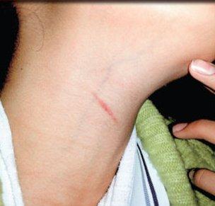 Ankara'da bir öğretmen öğrencisinin boğazını kesti