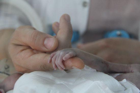 500 gram doğan parmak bebek hayata tutundu