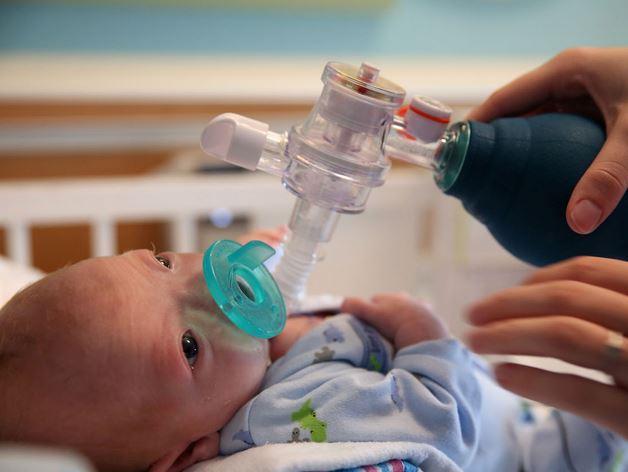 Alabama'da burunsuz bir bebek doğdu