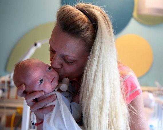 Alabama'da burunsuz bir bebek doğdu