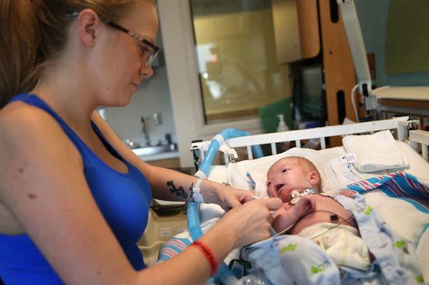 Alabama'da burunsuz bir bebek doğdu