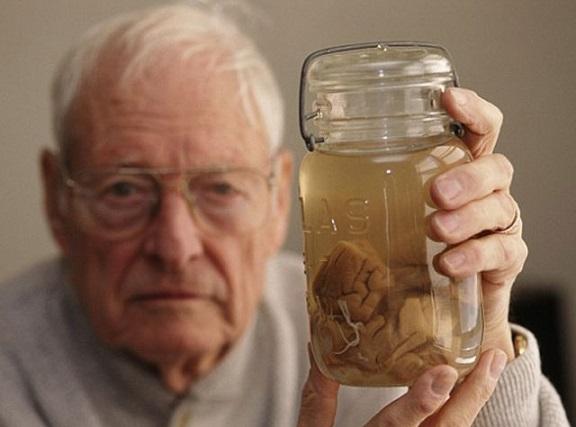 Müzede ziyarete açılan Einstein'ın beynine ilgi yoğun