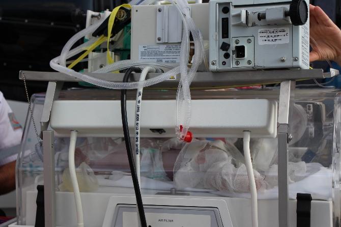 Bolu'da saç kurutma makinesi 13 günlük bebeği yaktı