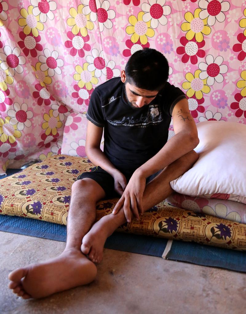 Savaşın engelli yaşamaya mahkum ettiği Suriyeliler