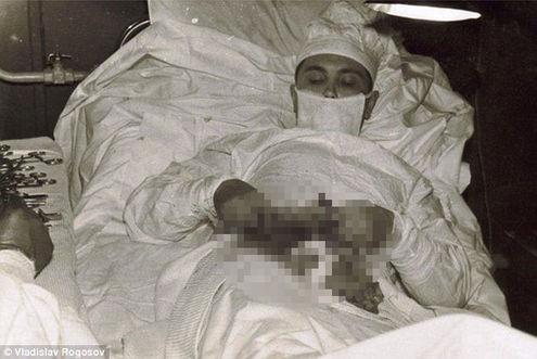 Kendi apandisit ameliyatını yaparak tarihe geçen doktor