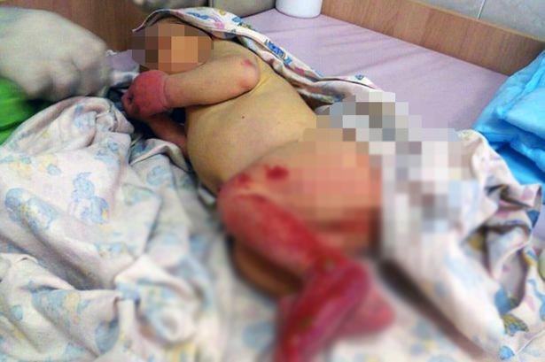 Rusya'da ormana terk edilen bebeği karıncalar yedi