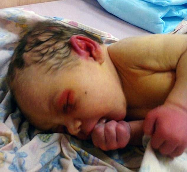 Rusya'da ormana terk edilen bebeği karıncalar yedi