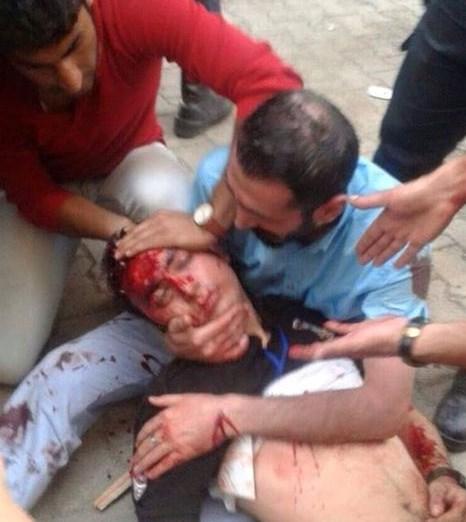 Diyarbakır’daki bombalı saldırıyla ilgili ayrıntılar