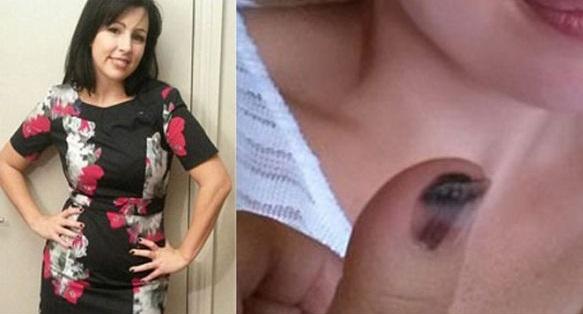 Tırnağınızdaki siyah lekeye dikkat edin