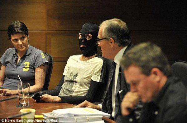 Maratonda vücudu yanan sporcu sevgilisi ile nişanlandı