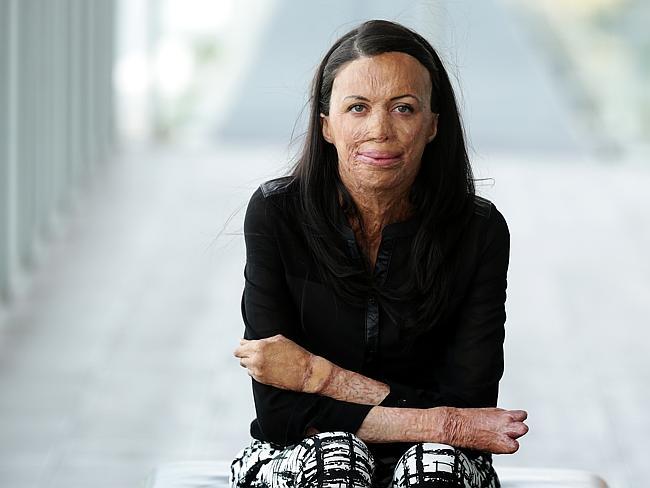 Maratonda vücudu yanan sporcu sevgilisi ile nişanlandı