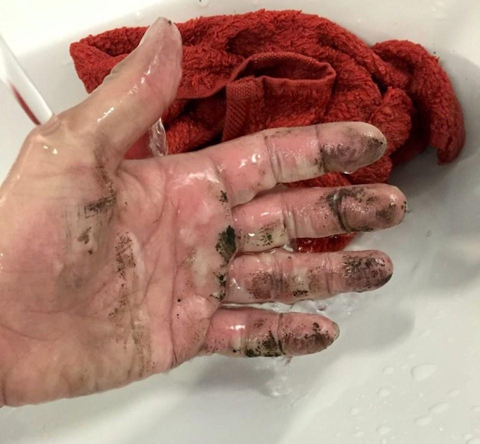 Patlayan şarj cihazı elini yaktı