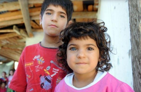 Bu çocukların gözlerinin biri mavi biri kahverengi