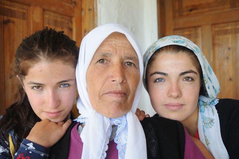 Bu çocukların gözlerinin biri mavi biri kahverengi