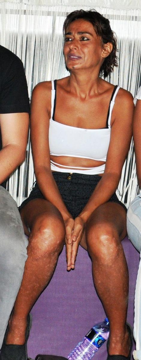 Yıldız Tilbe: Bacaklarımı çekmeyin