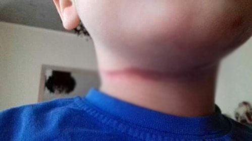 Belçika'da öğretmen öğrencisini darp etti