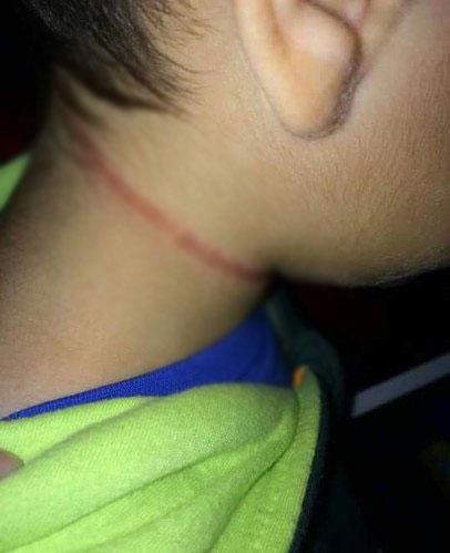 Belçika'da öğretmen öğrencisini darp etti