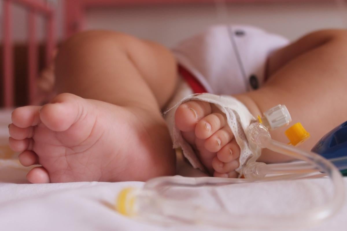 Mardin'de 24 parmaklı bebek görenleri şaşırttı