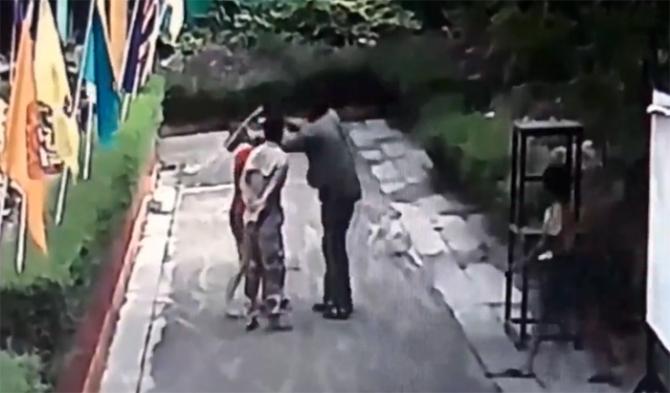 Boşanmak isteyen eşinin yüzüne kezzap attı