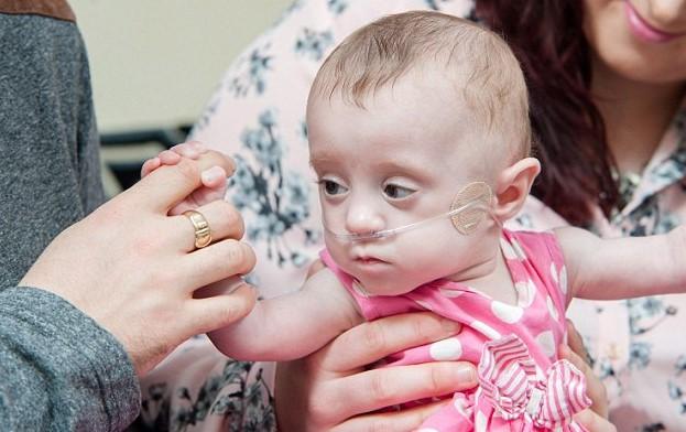 23 haftalık doğan bebek hayata tutundu