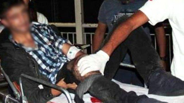 İzne gelen asker polise molotof atarken yaralandı