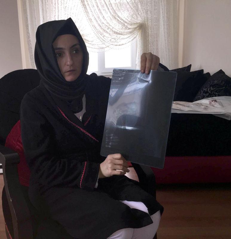 Ameliyat olan kadının karnında mala unuttular